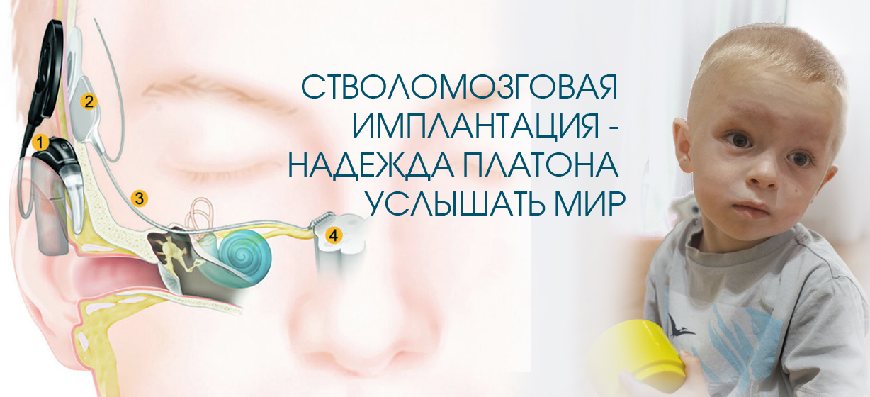 Иконка в новость_стволомозговая копия.jpg